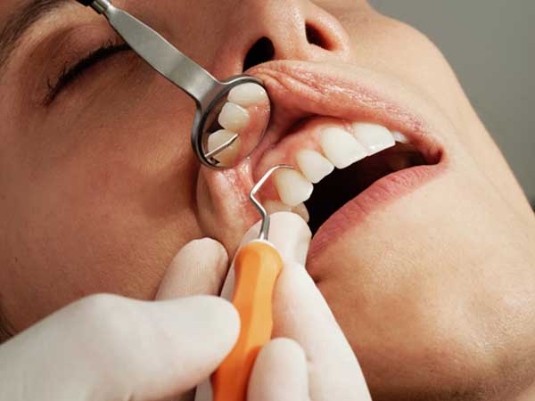 periodontal care and teeth cleanings