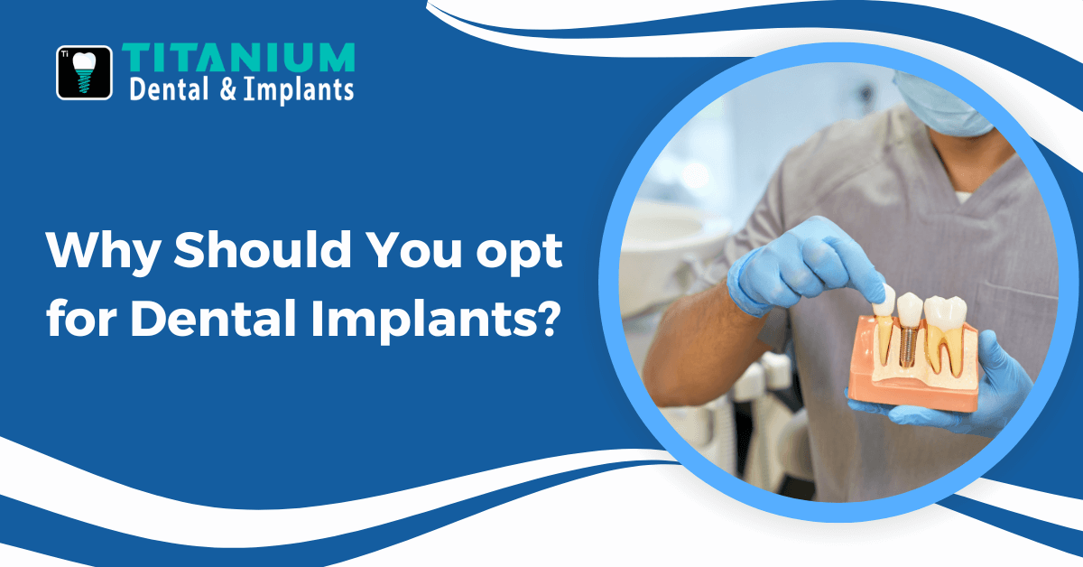 Why Should You opt for Dental Implants?