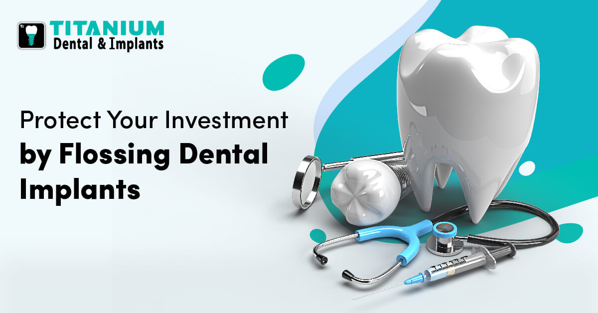Protect Your Investment by Flossing Dental Implants