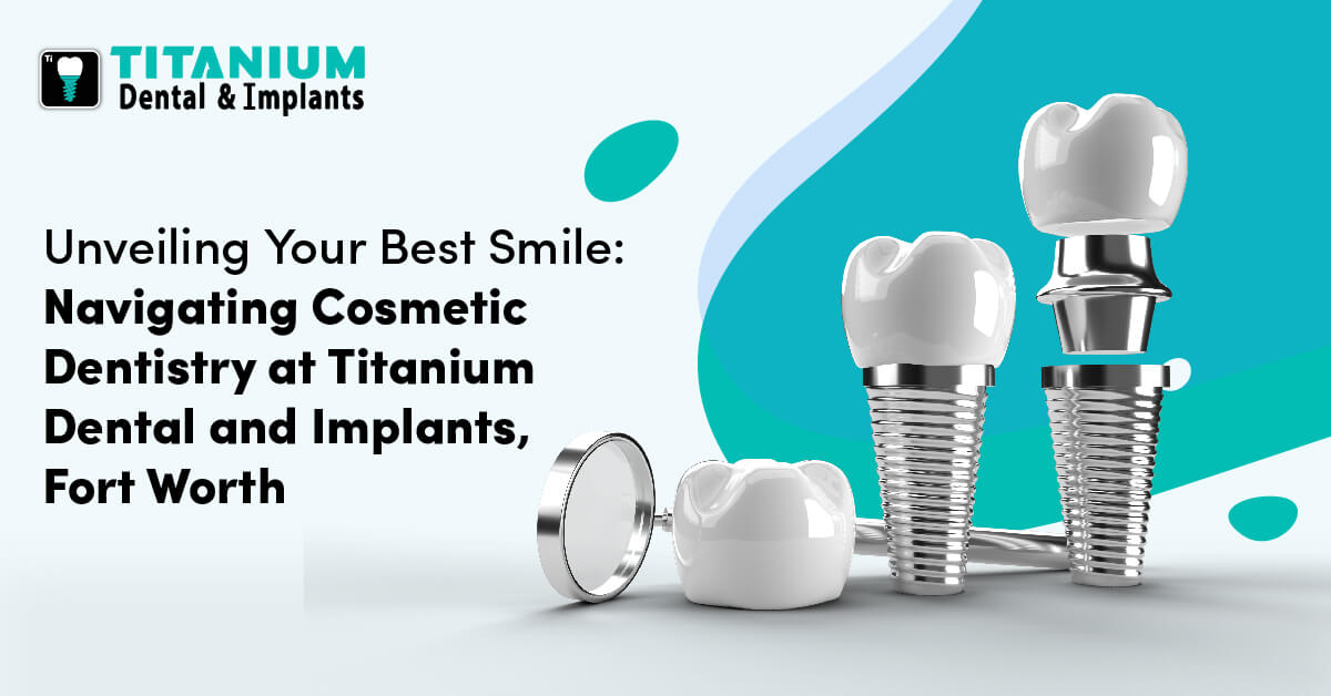 Unveiling Your Best Smile: Navigating Cosmetic Dentistry at Titanium Dental and Implants, Fort Worth